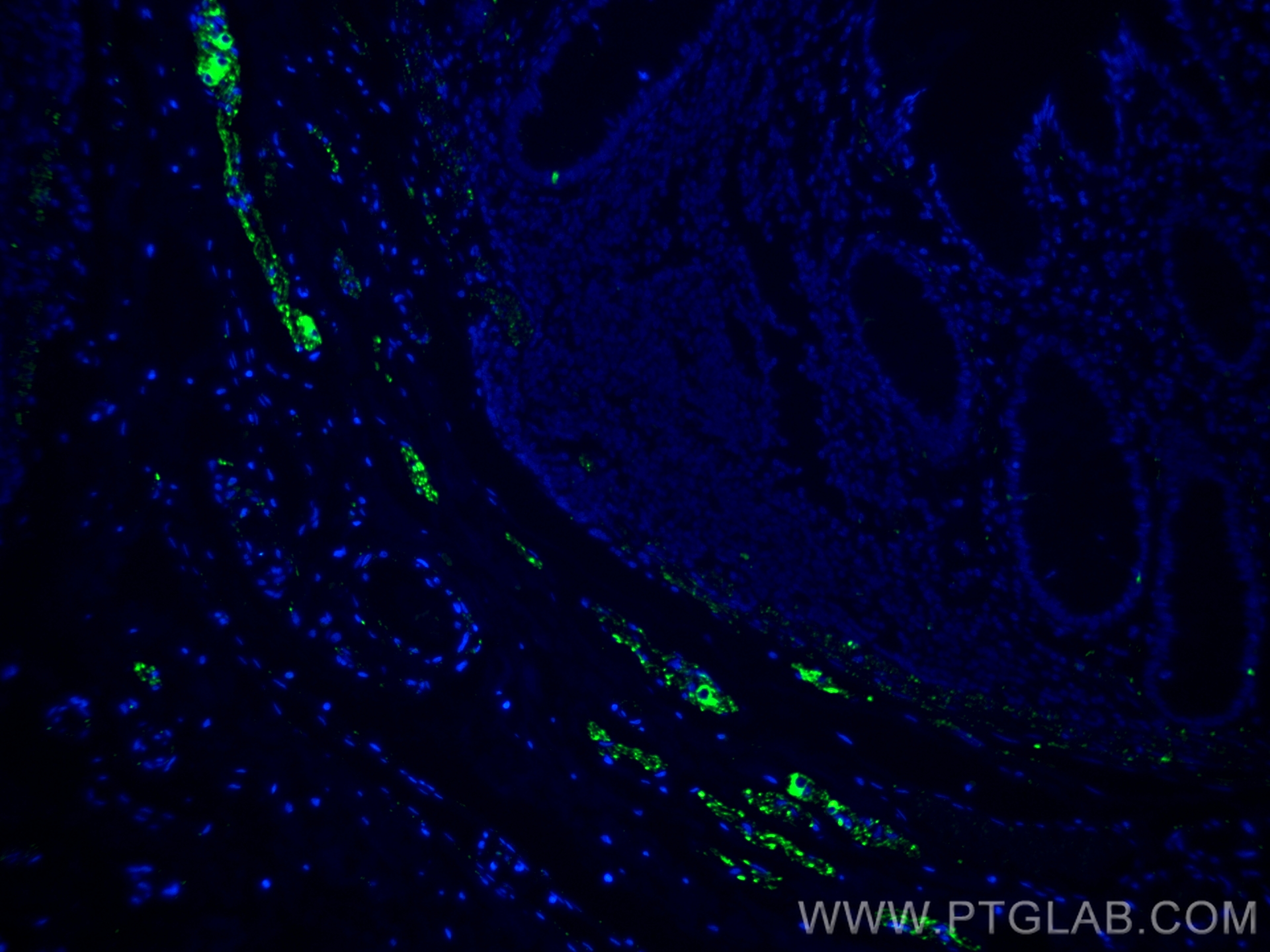IF Staining of human colon using 17399-1-AP