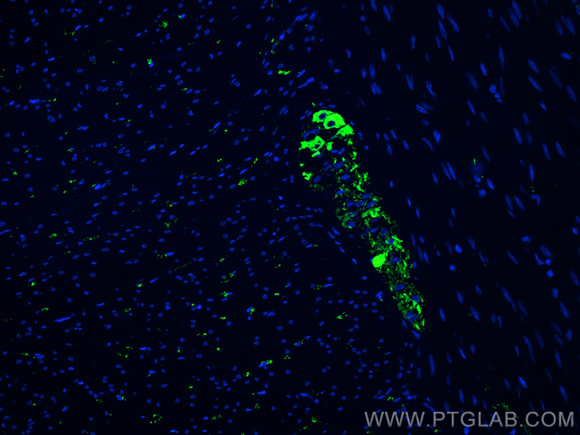 IF Staining of human colon using 17399-1-AP