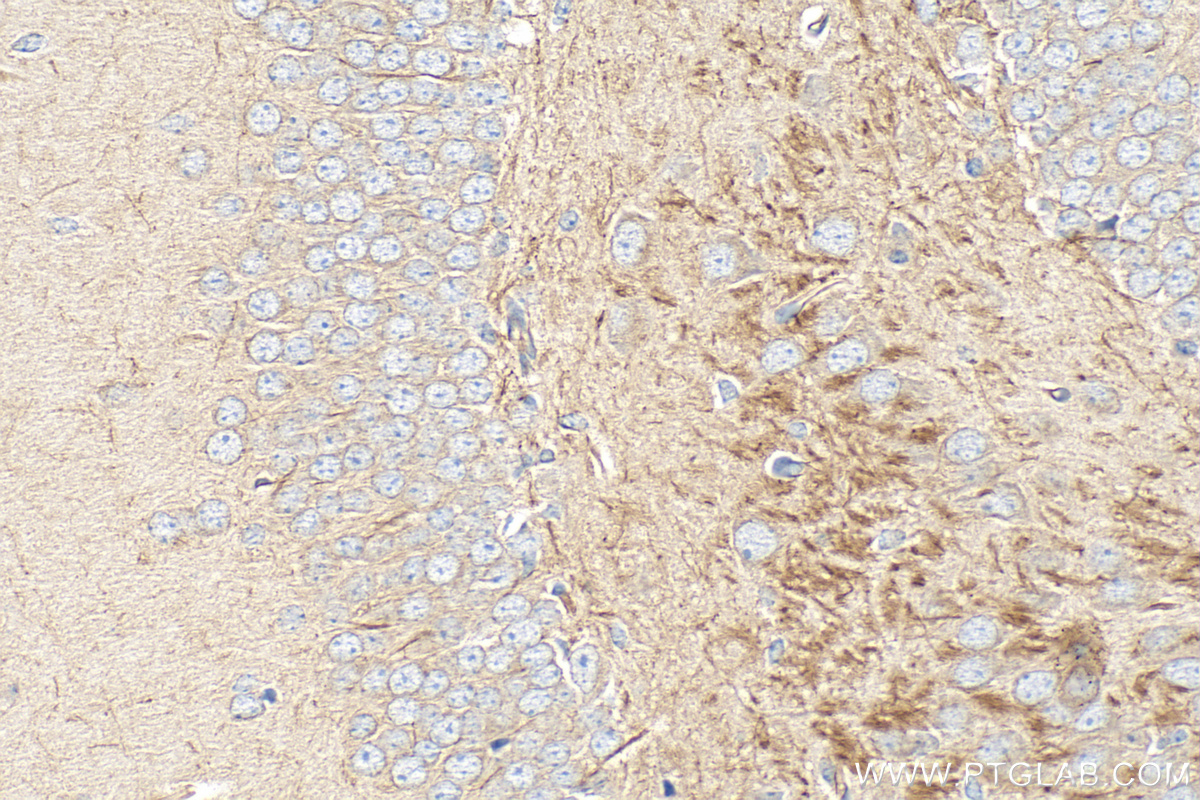 IHC staining of mouse brain using 17399-1-AP