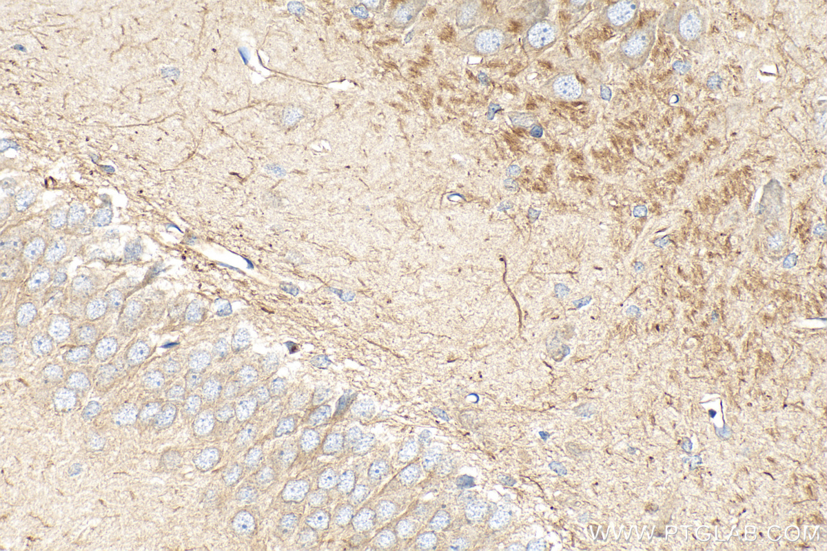 IHC staining of rat brain using 17399-1-AP