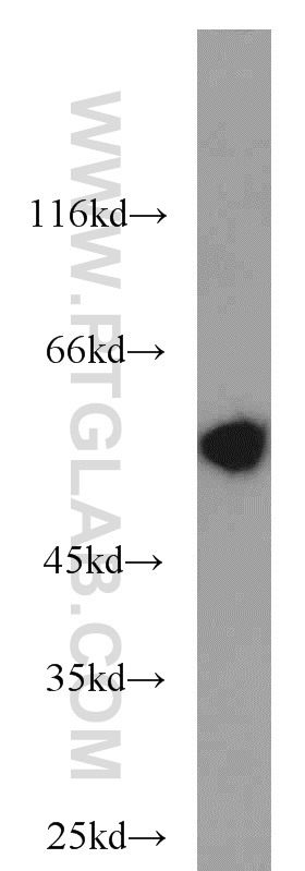 WB analysis of mouse colon using 17399-1-AP