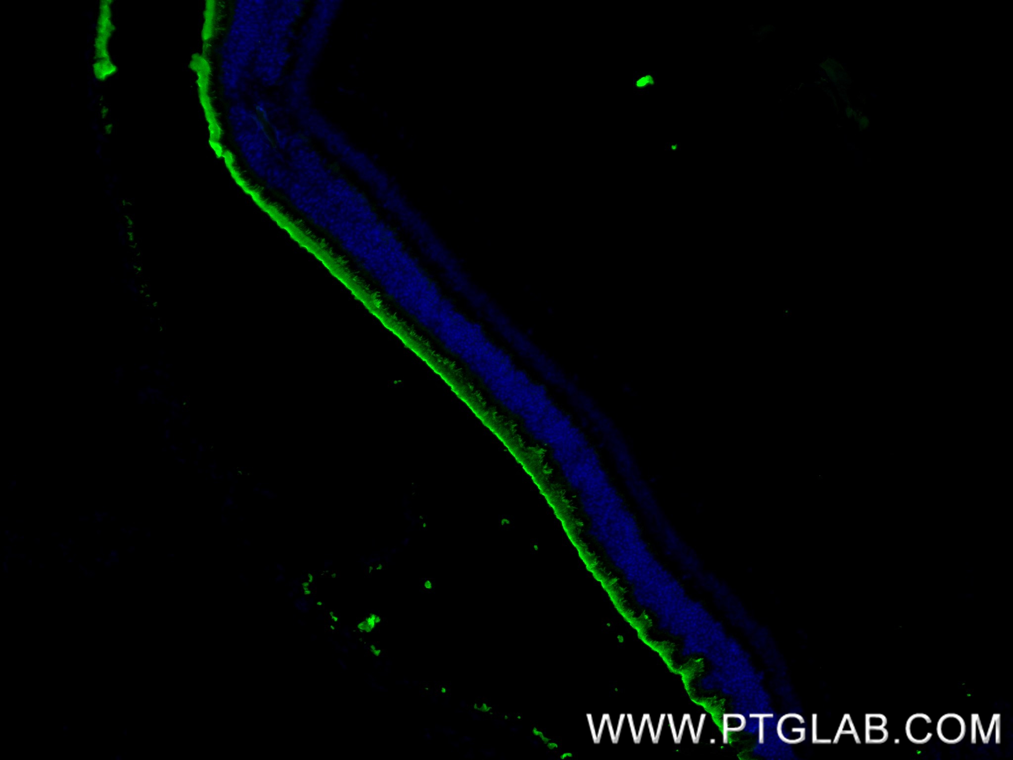 IF Staining of mouse eye using 85043-1-RR