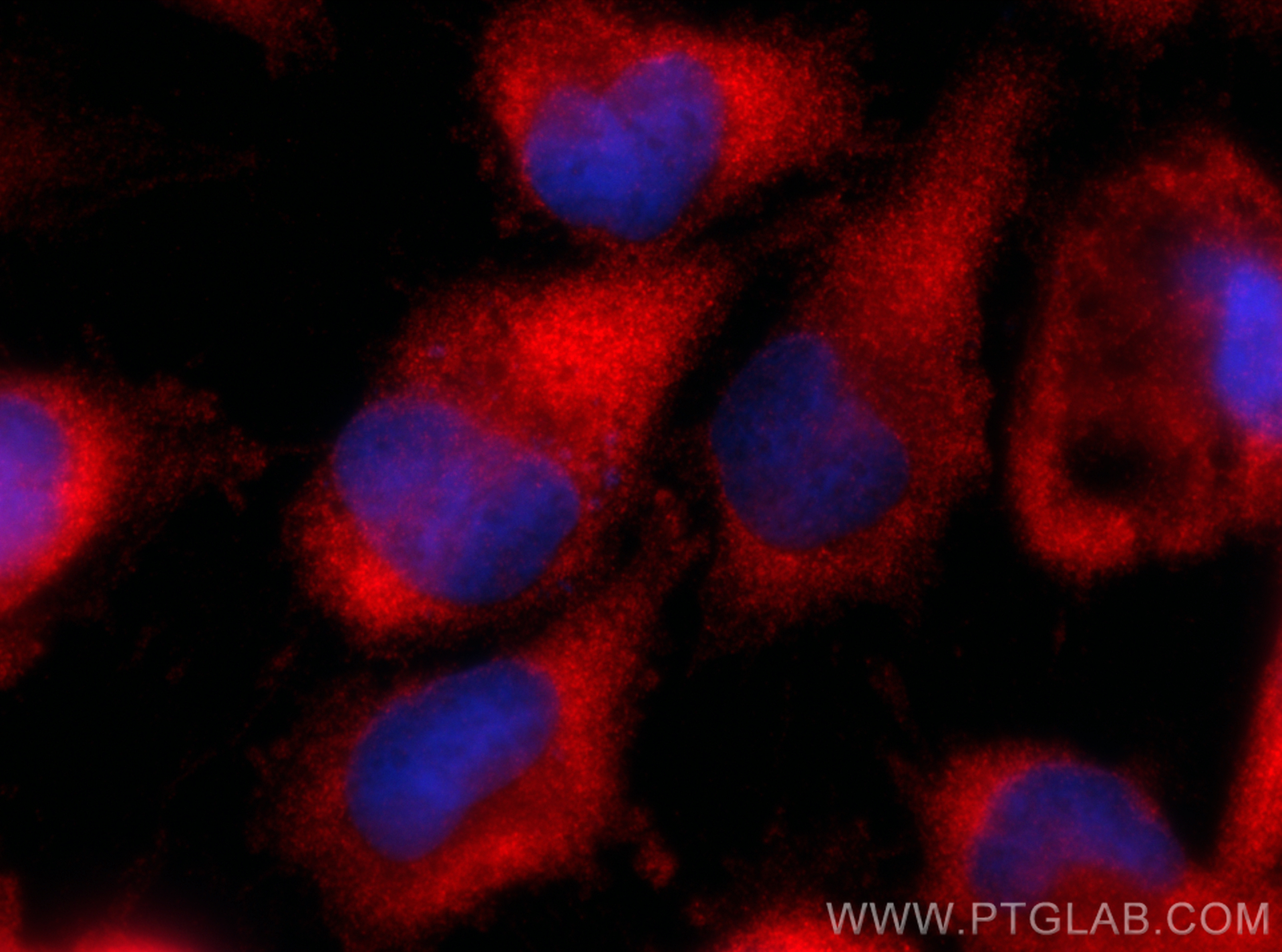 IF Staining of U-251 using 15549-1-AP