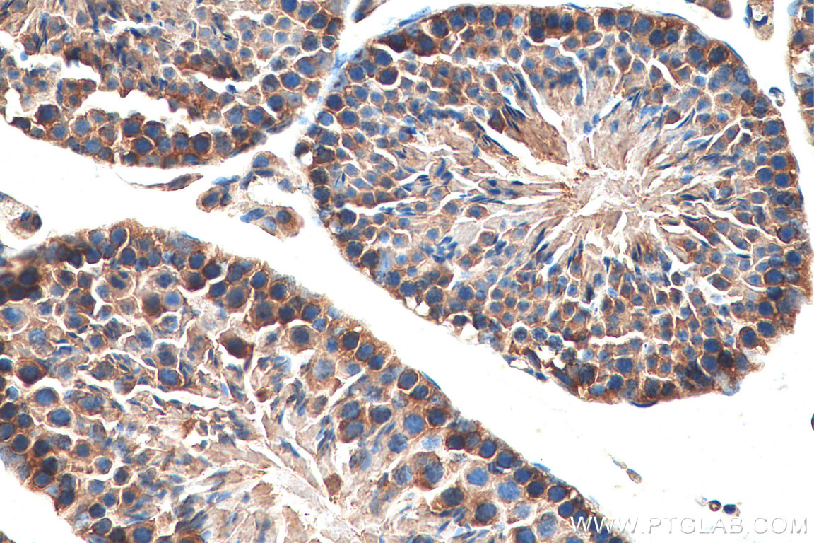 IHC staining of mouse testis using 15549-1-AP