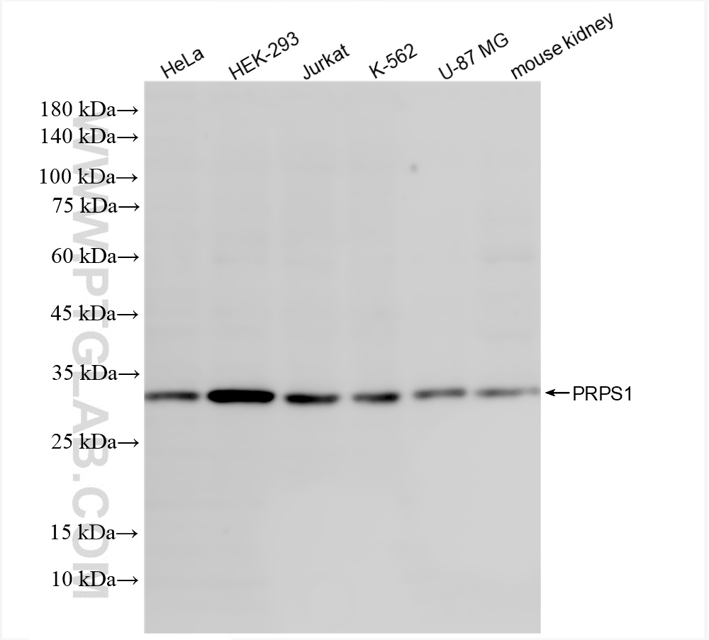 WB analysis using 86217-1-RR