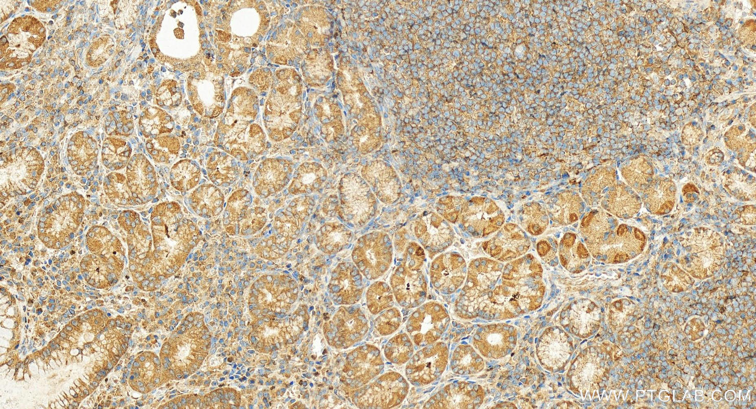 IHC staining of human stomach using 27024-1-AP