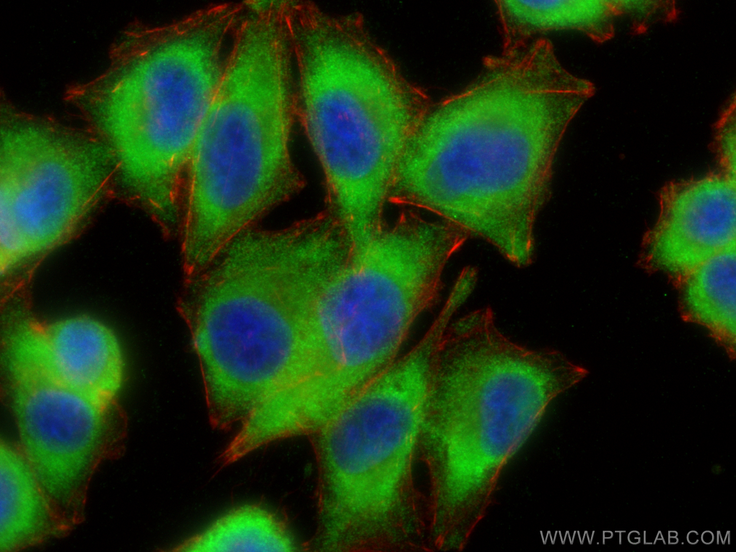 IF Staining of A375 using 27024-1-AP