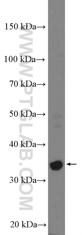 A375 cells were subjected to SDS PAGE followed by western blot with 27024-1-AP (PRPS2 Antibody) at dilution of 1:2000 incubated at room temperature for 1.5 hours. WB analysis of A375 using 27024-1-AP