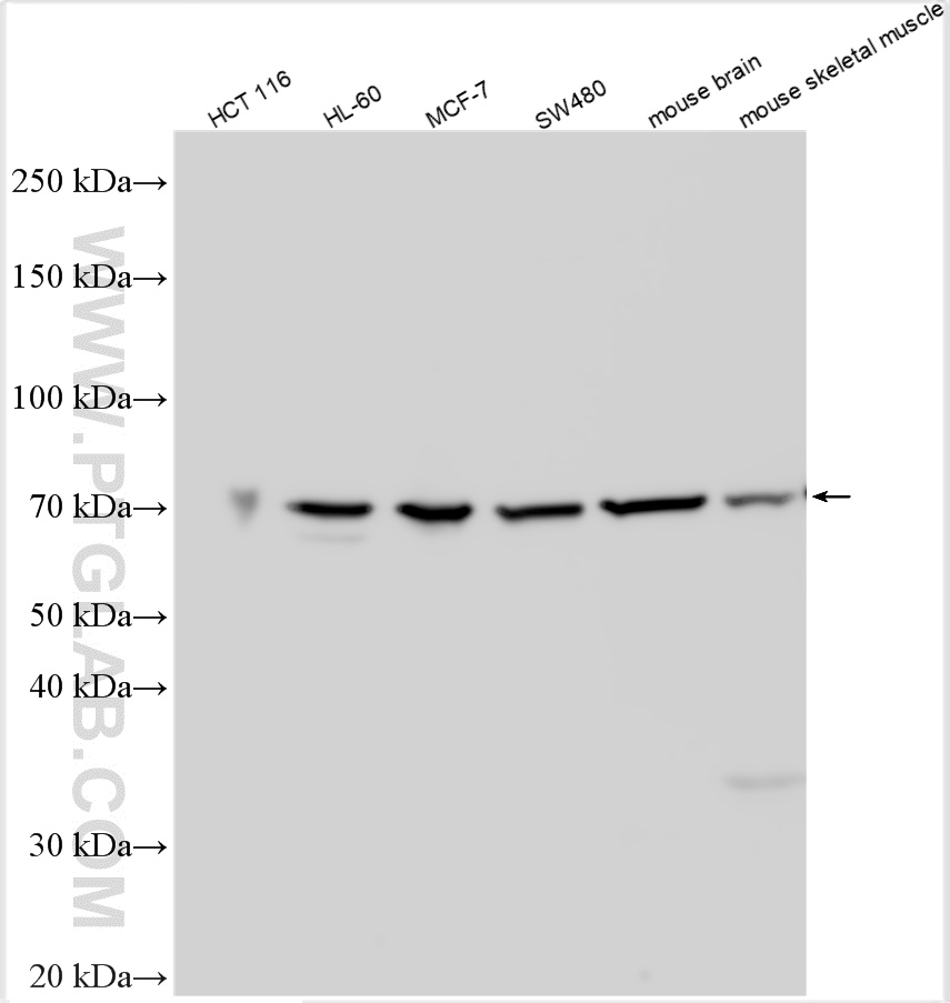 WB analysis using 22819-1-AP