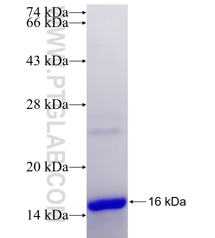 PRR16 fusion protein Ag21662 SDS-PAGE PRR16 fusion protein Ag21662 SDS-PAGE