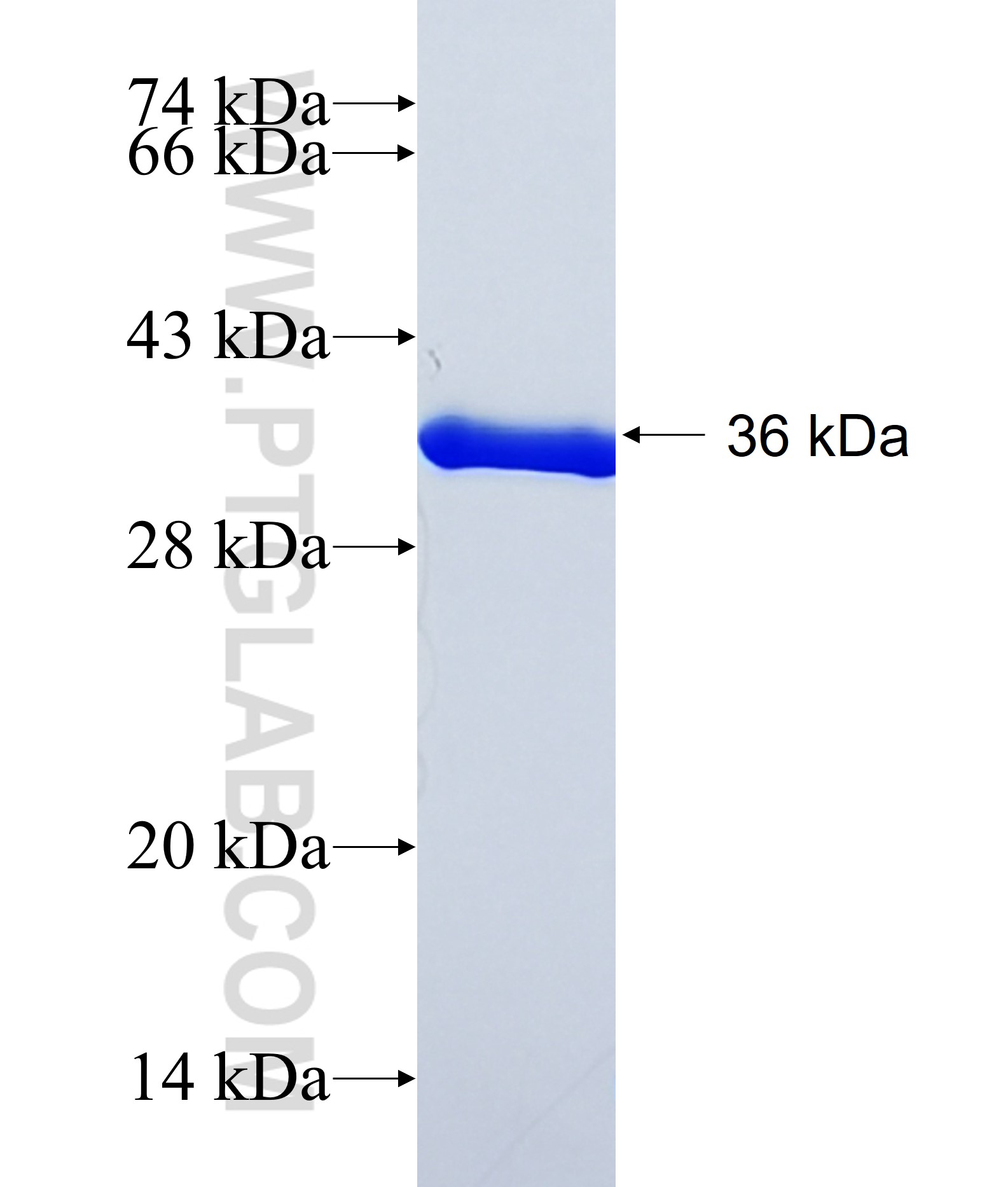 PRR4 fusion protein Ag39861 SDS-PAGE PRR4 fusion protein Ag39861 SDS-PAGE