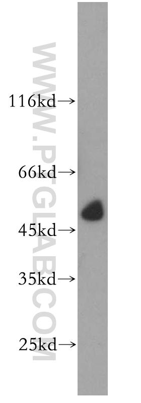 WB analysis of human kidney using 17948-1-AP