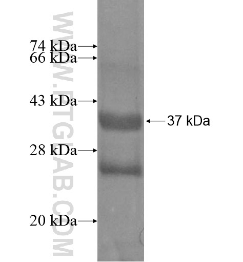 PRR5 fusion protein Ag12296 SDS-PAGE PRR5 fusion protein Ag12296 SDS-PAGE
