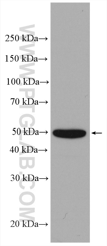 WB analysis of HeLa using 27887-1-AP