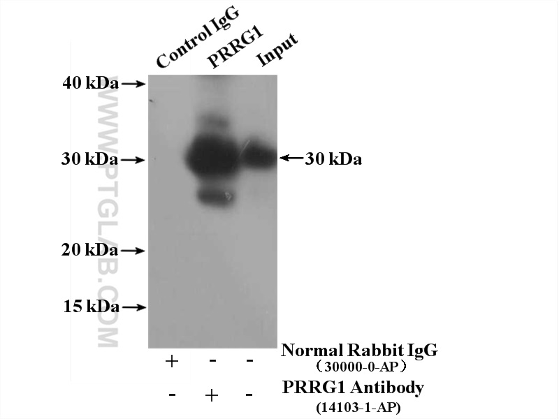 IP experiment of HepG2 using 14103-1-AP