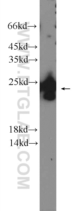 WB analysis of HepG2 using 14103-1-AP