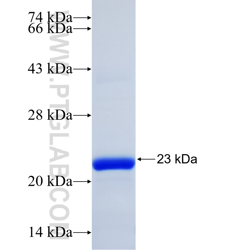 PRRG2 fusion protein Ag35095 SDS-PAGE