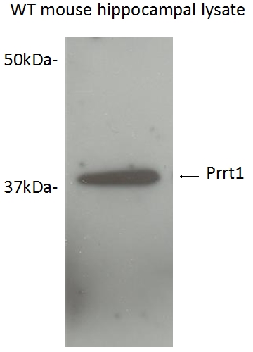 WB analysis of mouse hippocampal tissue using 17261-1-AP