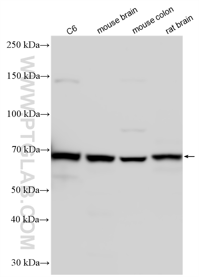 WB analysis using 26572-1-AP WB analysis using 26572-1-AP