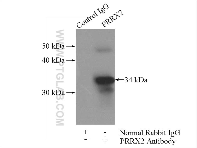 IP experiment of mouse brain using 23869-1-AP