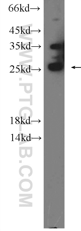 WB analysis of mouse brain using 23869-1-AP