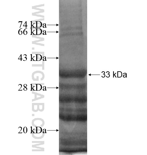 PRRX2 fusion protein Ag13503 SDS-PAGE PRRX2 fusion protein Ag13503 SDS-PAGE