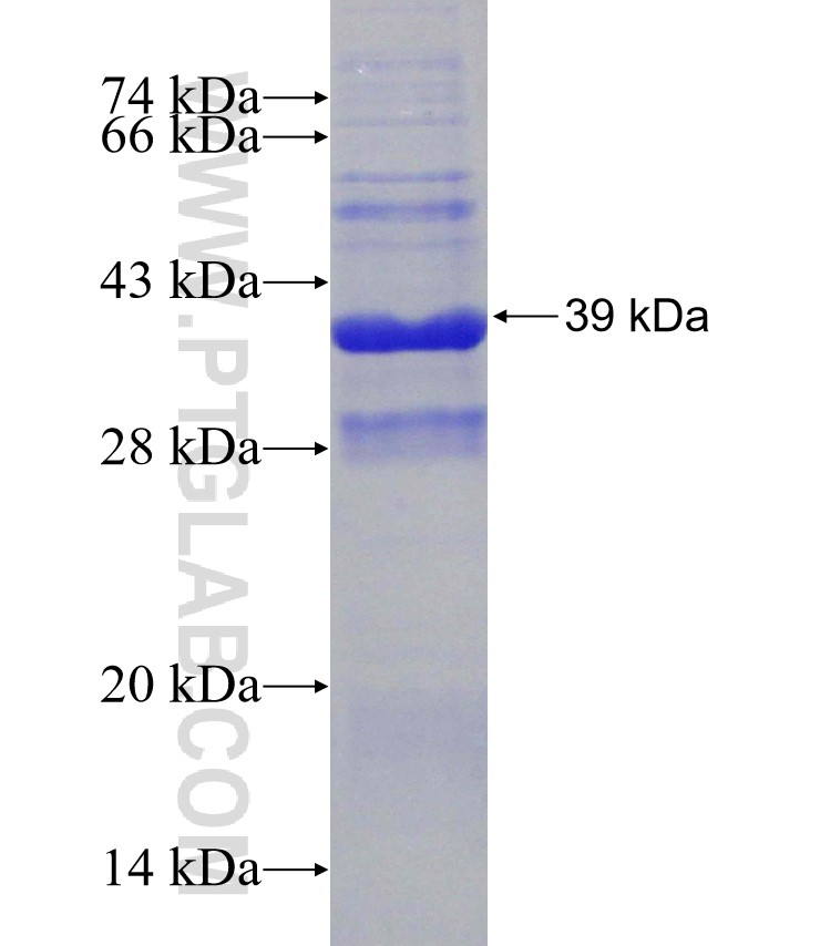 PRSS1 fusion protein Ag31383 SDS-PAGE