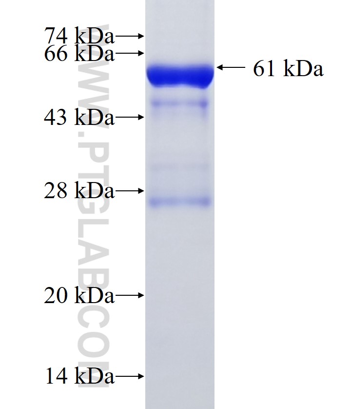 PRSS16 fusion protein Ag33961 SDS-PAGE