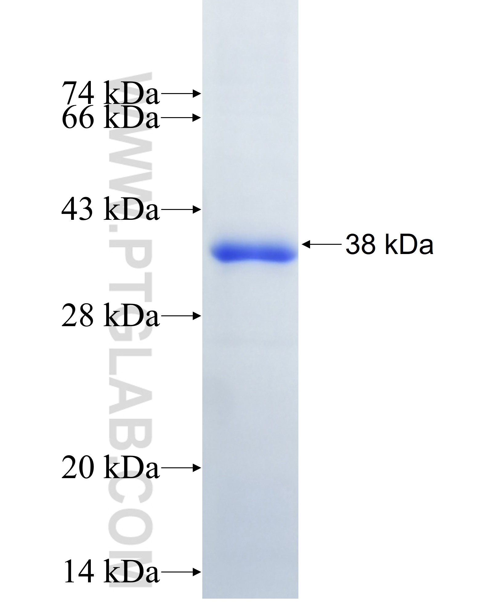 PRSS2 fusion protein Ag38120 SDS-PAGE PRSS2 fusion protein Ag38120 SDS-PAGE