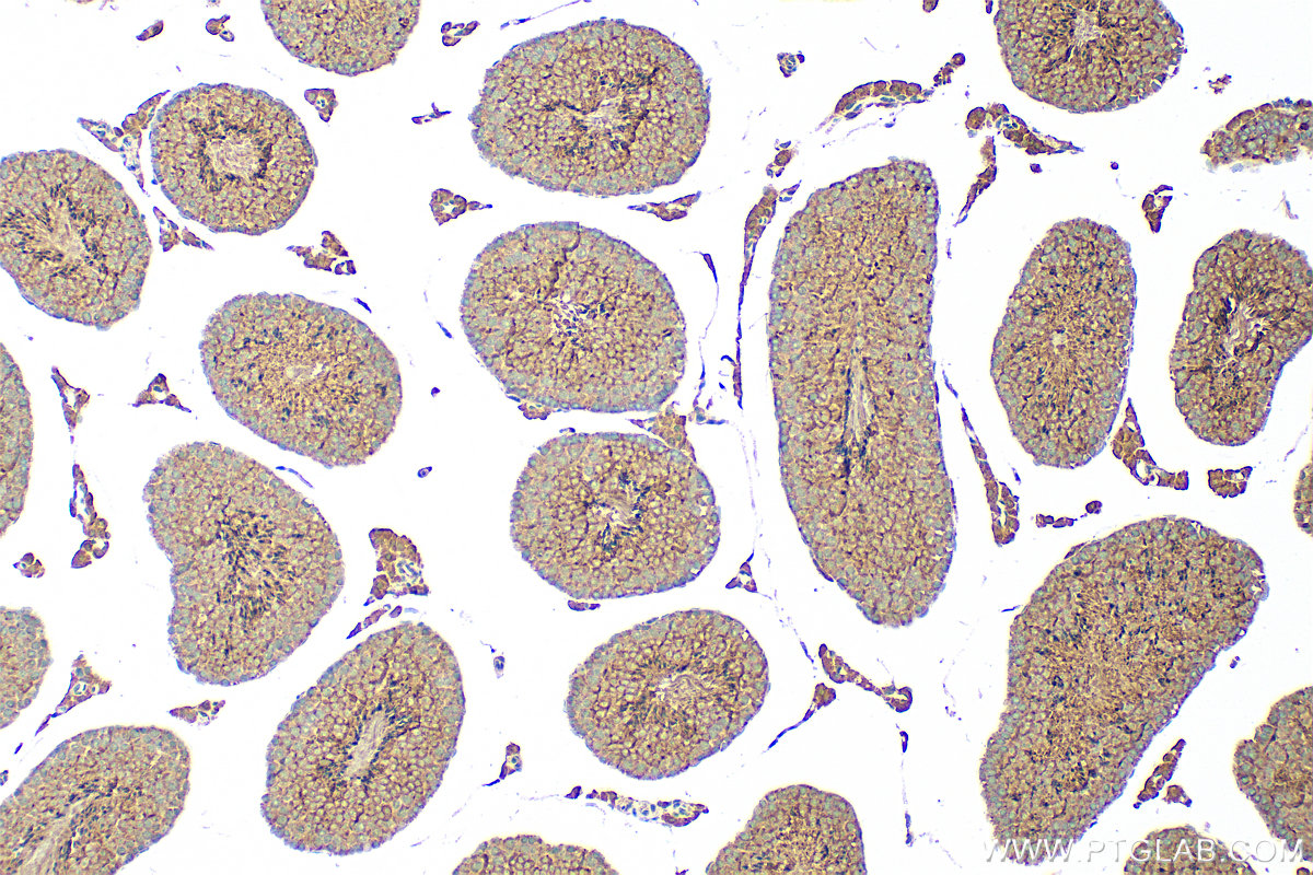 IHC staining of mouse testis using 32522-1-AP