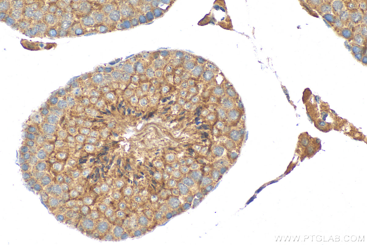 IHC staining of mouse testis using 32522-1-AP