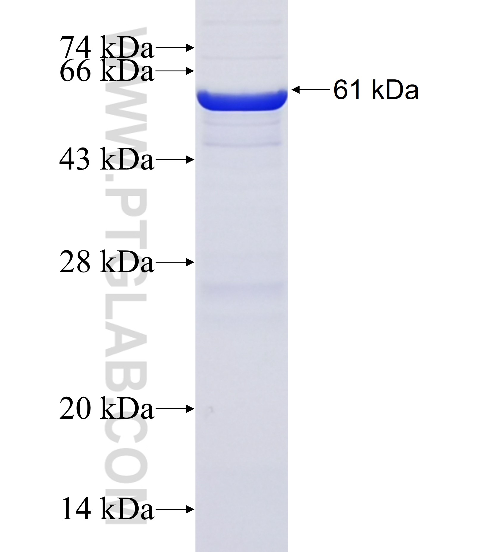 PRSS21 fusion protein Ag38156 SDS-PAGE PRSS21 fusion protein Ag38156 SDS-PAGE