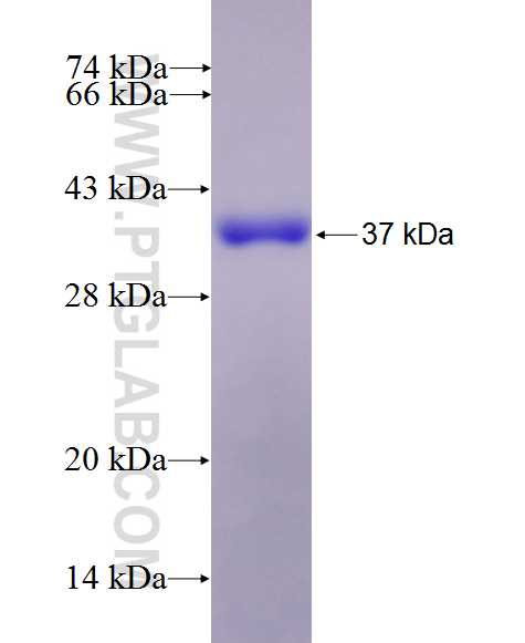 PRSS7 fusion protein Ag27103 SDS-PAGE PRSS7 fusion protein Ag27103 SDS-PAGE