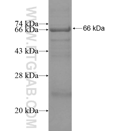 PRSS7 fusion protein Ag15209 SDS-PAGE PRSS7 fusion protein Ag15209 SDS-PAGE