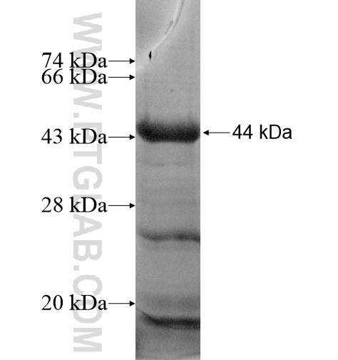 PRSS7 fusion protein Ag15296 SDS-PAGE PRSS7 fusion protein Ag15296 SDS-PAGE