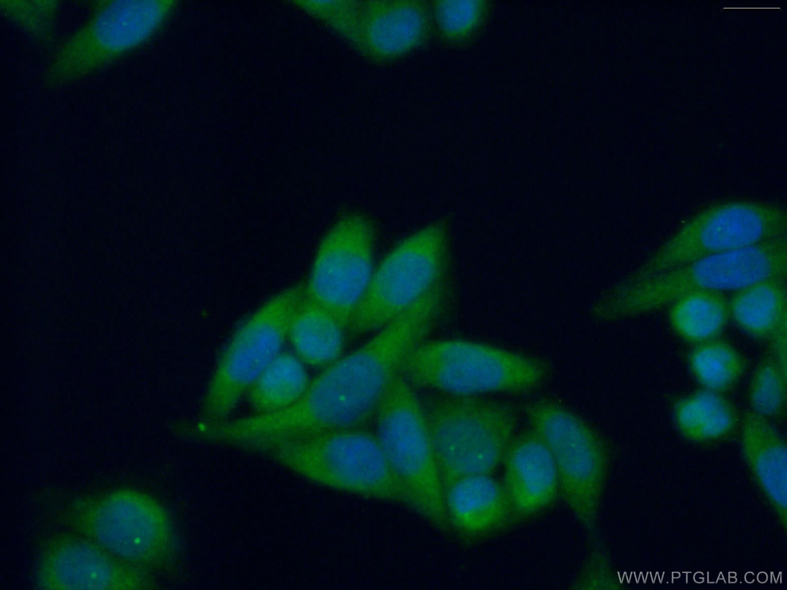 IF Staining of HeLa using 11986-1-AP