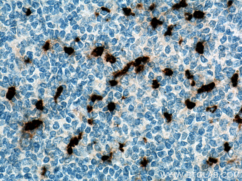 IHC staining of human tonsillitis using 25278-1-AP