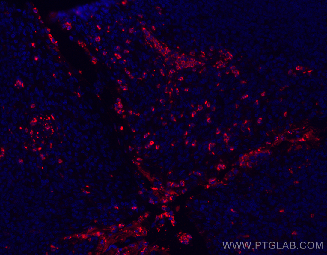 IF Staining of human tonsillitis using 67030-1-Ig
