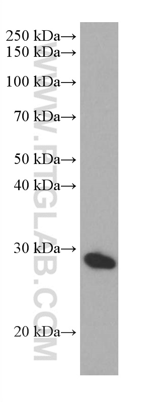 WB analysis of human placenta using 67030-1-Ig