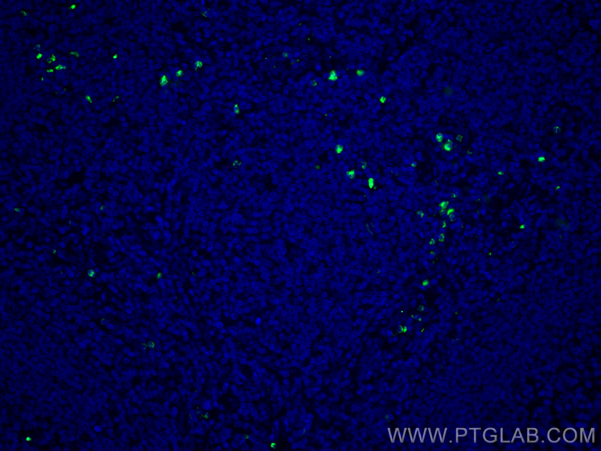 IF Staining of human tonsillitis using CL488-67030