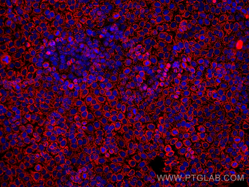 IF Staining of HepG2 using 66810-1-Ig (same clone as 66810-1-PBS)