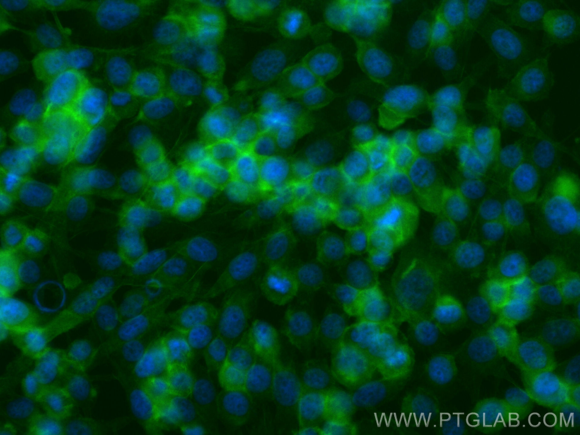 IF Staining of PC-3 using 24688-1-AP