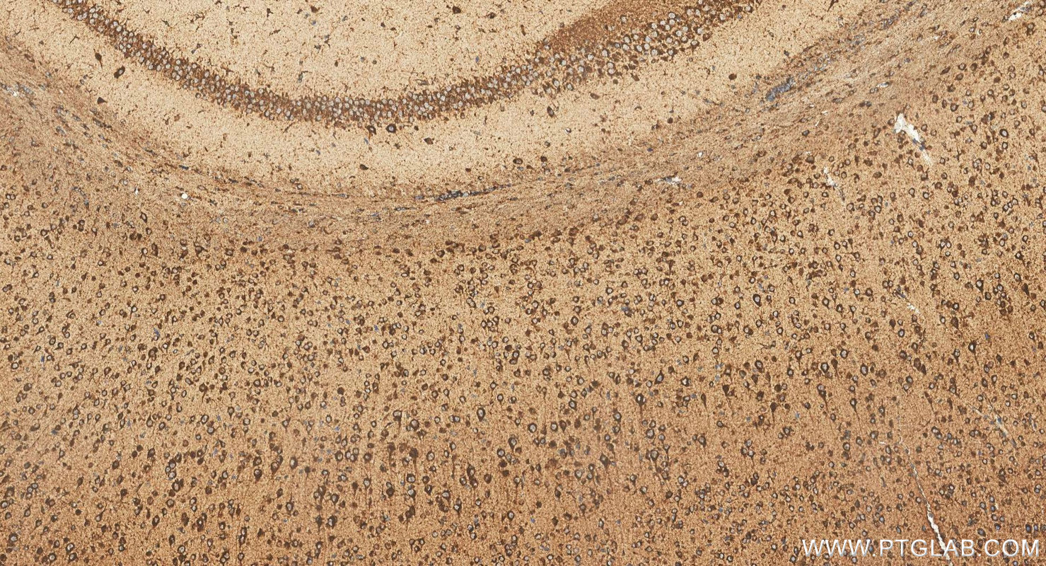 IHC staining of mouse brain using 18423-1-AP IHC staining of mouse brain using 18423-1-AP