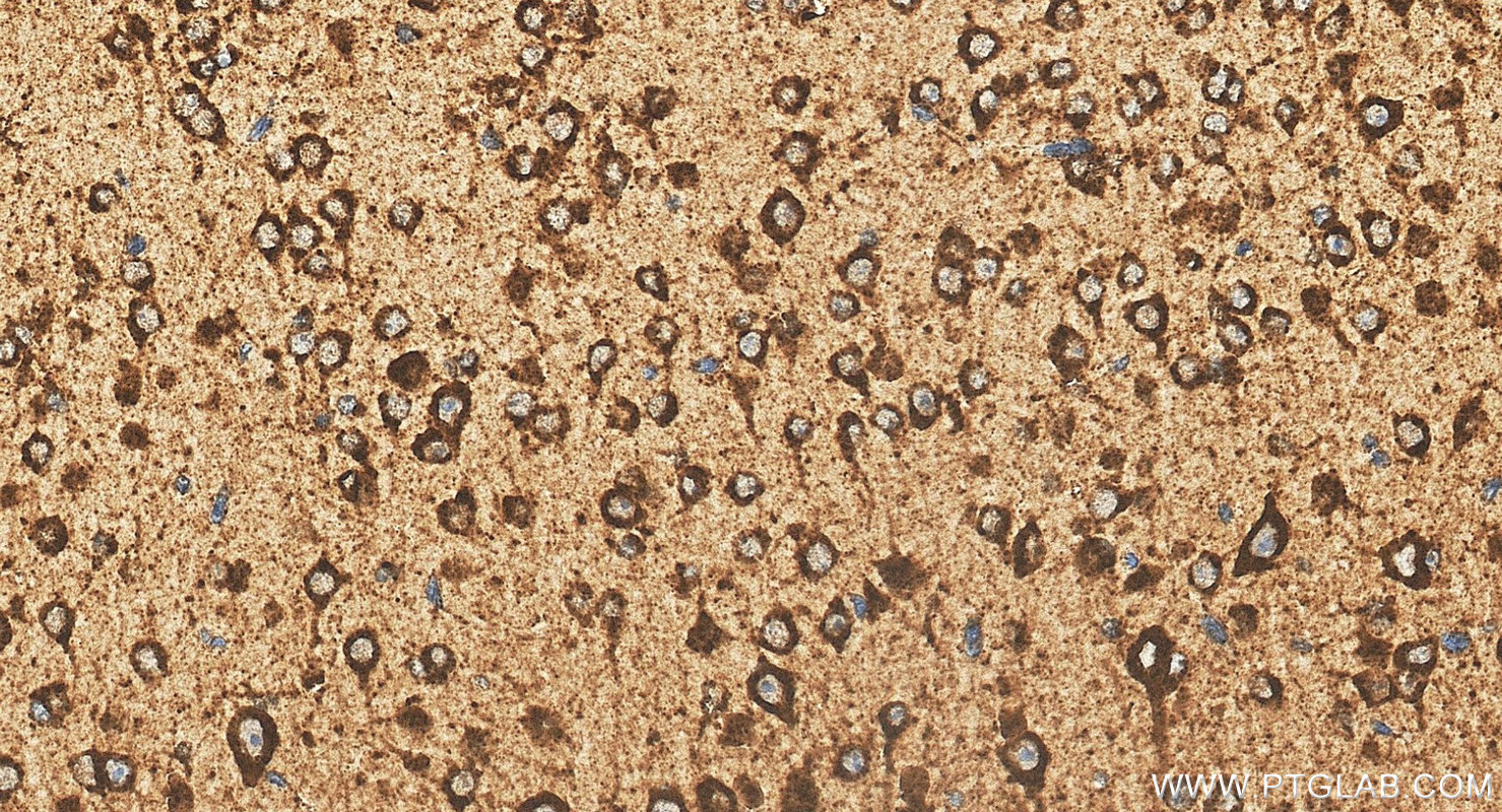 IHC staining of mouse brain using 18423-1-AP IHC staining of mouse brain using 18423-1-AP
