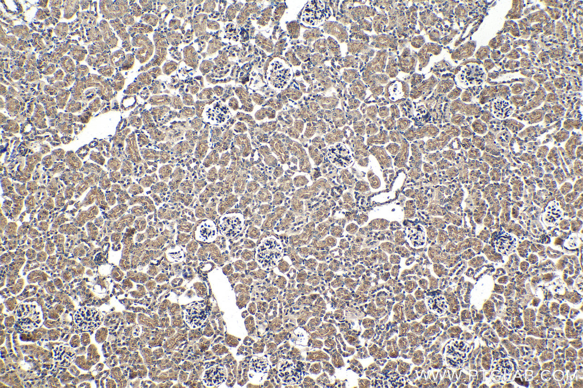 IHC staining of mouse kidney using 66473-1-Ig (same clone as 66473-1-PBS) IHC staining of mouse kidney using 66473-1-Ig (same clone as 66473-1-PBS)