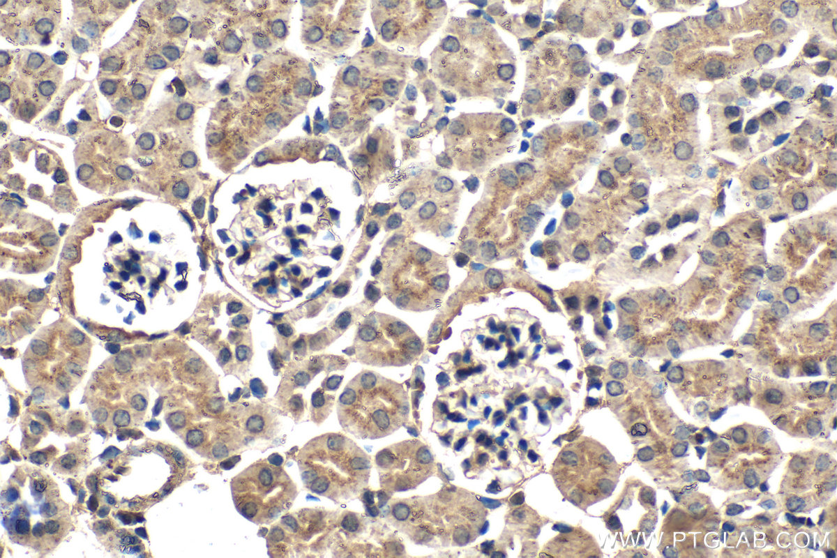 IHC staining of mouse kidney using 66473-1-Ig (same clone as 66473-1-PBS) IHC staining of mouse kidney using 66473-1-Ig (same clone as 66473-1-PBS)