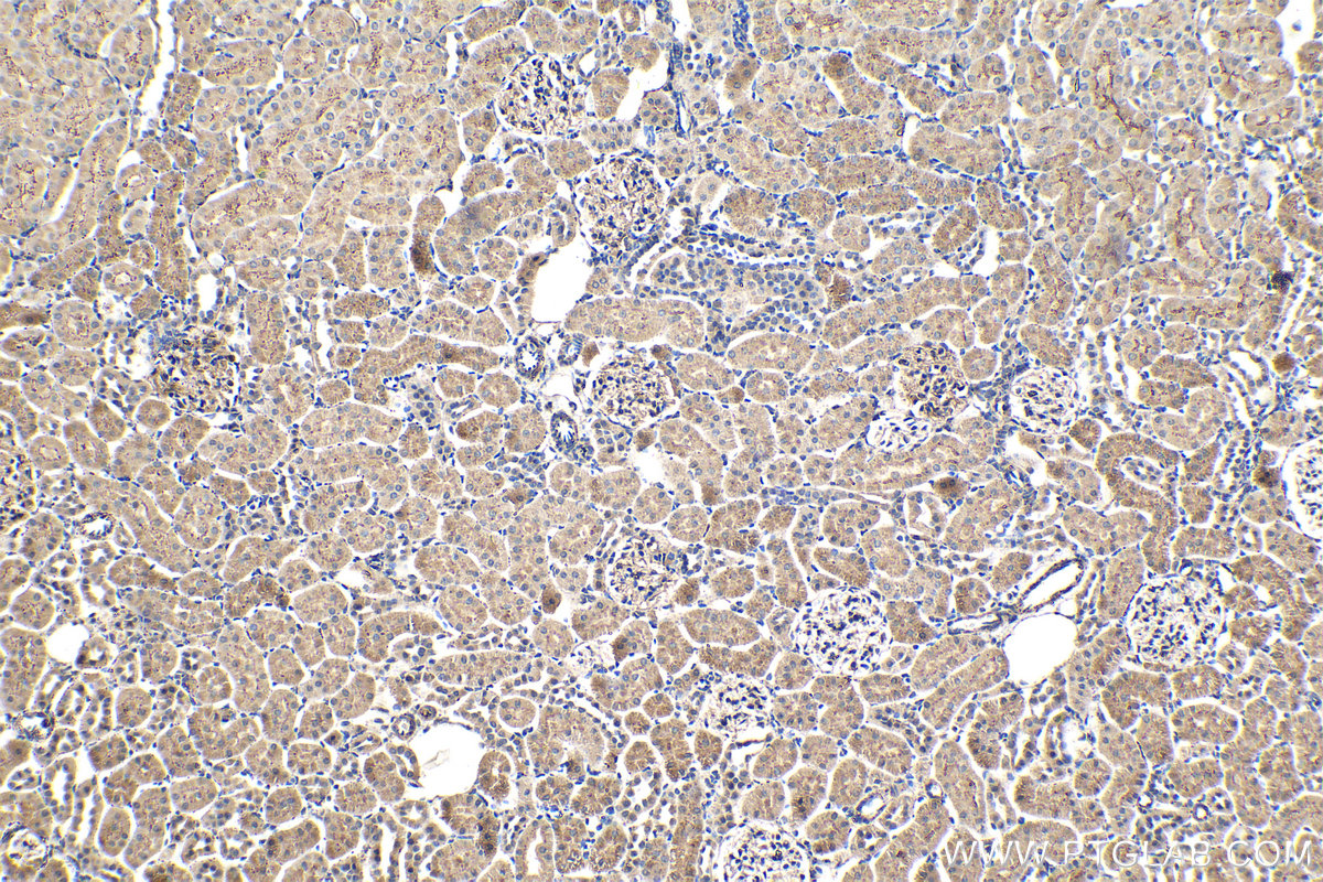 IHC staining of rat kidney using 66473-1-Ig (same clone as 66473-1-PBS) IHC staining of rat kidney using 66473-1-Ig (same clone as 66473-1-PBS)