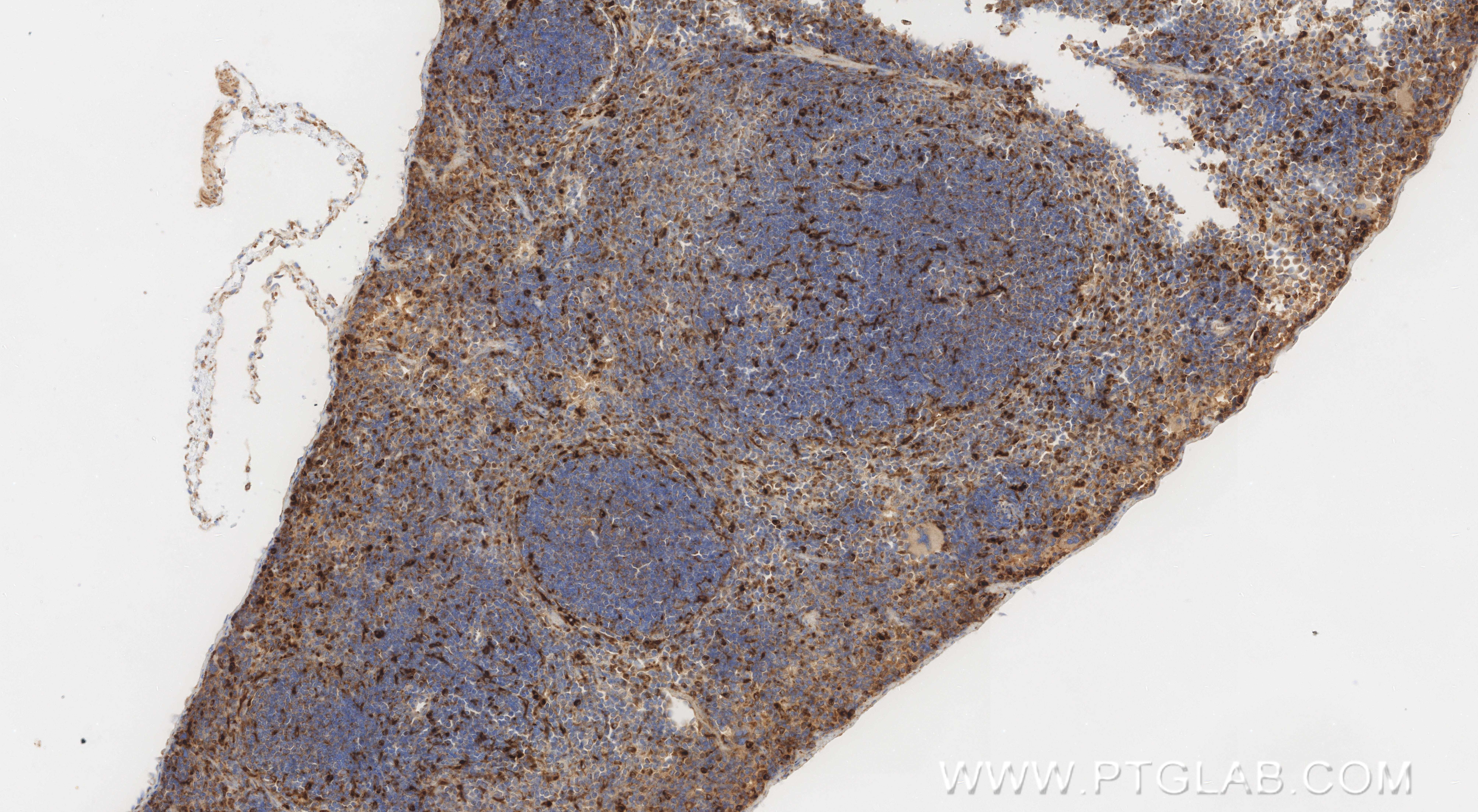 IHC staining of mouse spleen using 86043-2-RR