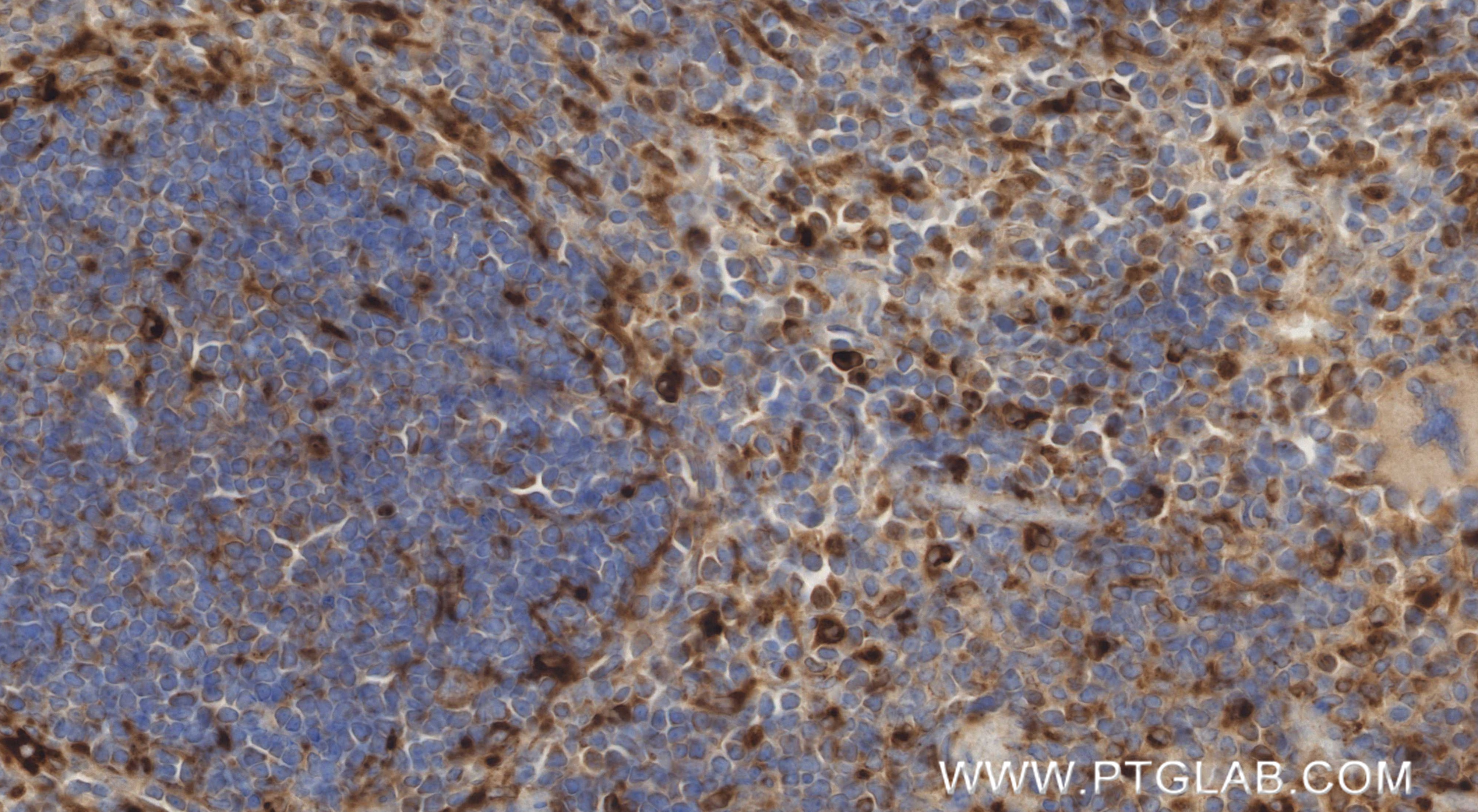IHC staining of mouse spleen using 86043-2-RR