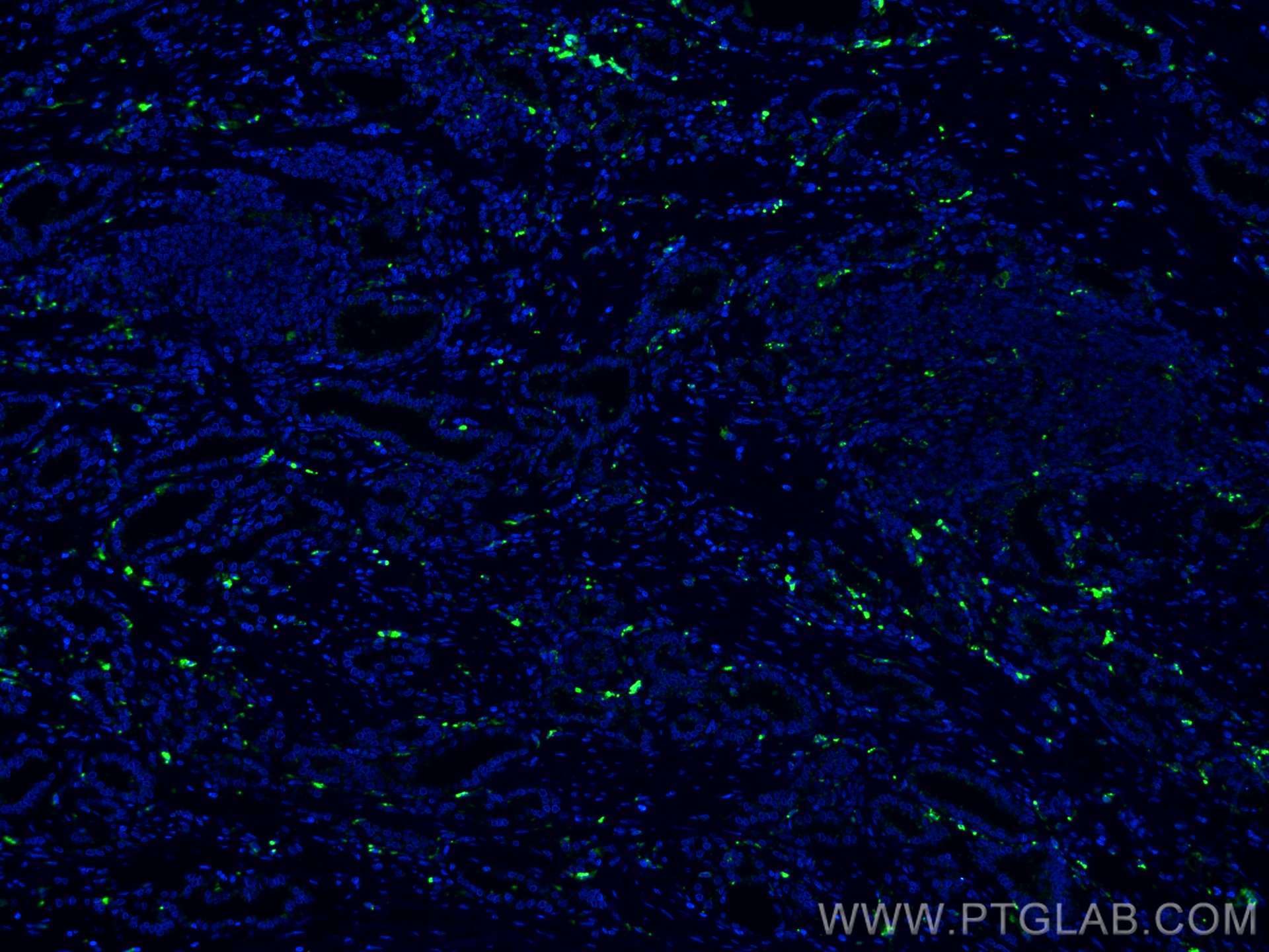 IF Staining of human prostate cancer using CL488-66473